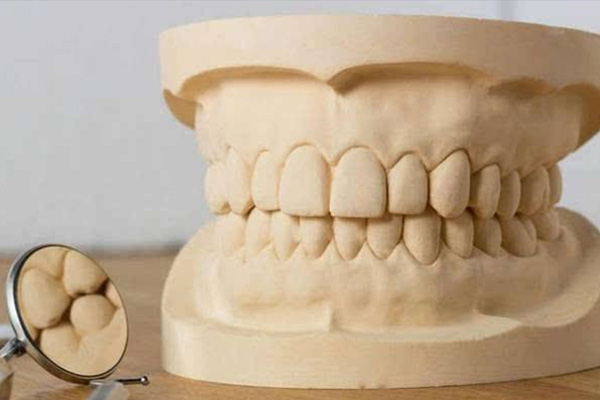 义齿价格大概是多少钱一颗？中老年口腔为您解答，如何选择高