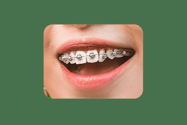 中老年缺牙患者的福音：活动矫正器