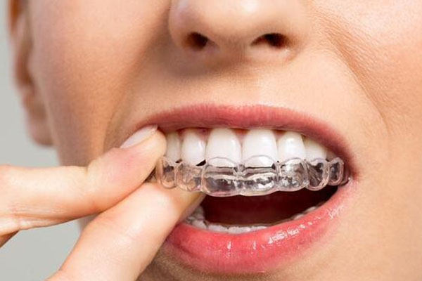 40岁矫正牙齿是否会影响牙齿寿命？中