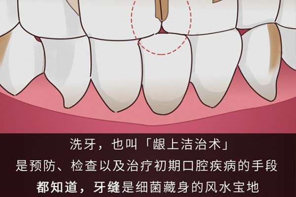 奉贤区中老年口腔医院：批量洗牙种牙新模式，缺牙修复效率翻