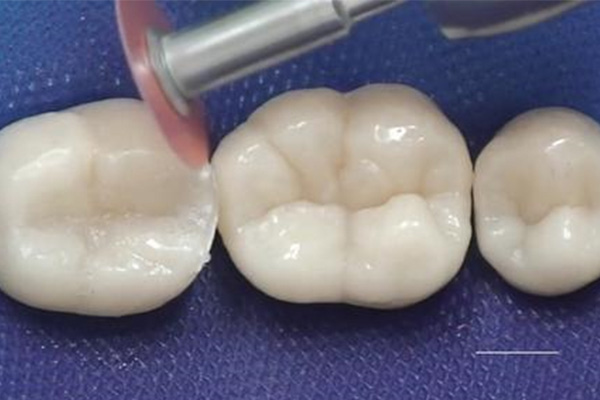 中老年口腔洗牙操作，高效解决牙齿问题