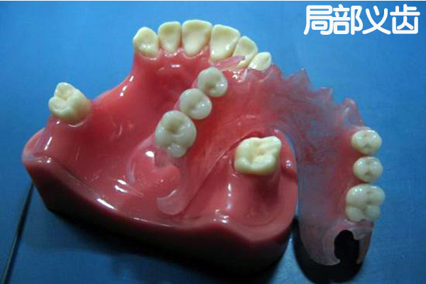 别让义齿伤害你！中老年口腔专家提