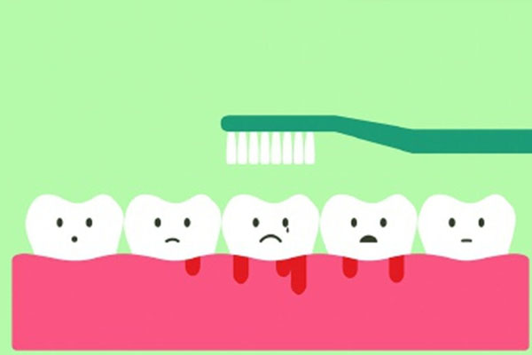 洗牙后为何建议更换牙刷？中老年口腔专家为您解答