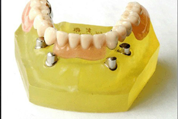 重庆欣乐美义齿制作有限公司：中老