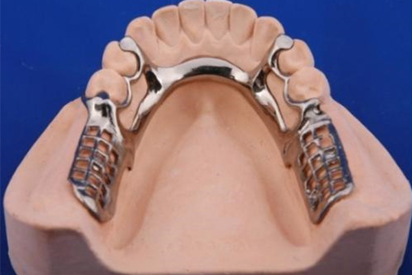 中老年人做一颗活动假牙大概需要多少钱？费用透明告诉你