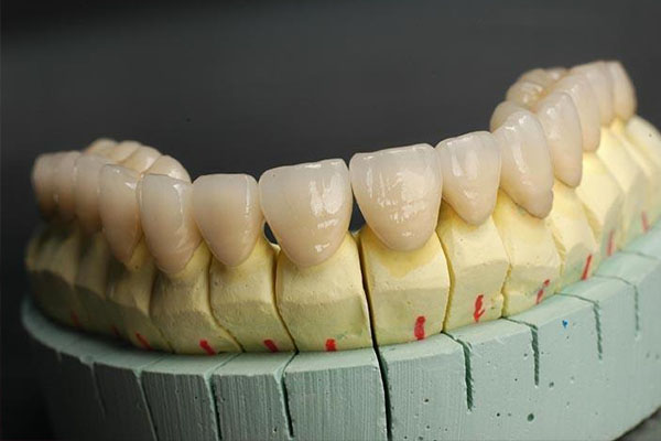 活动假牙固定方法全解析：中老年口腔专业解答，轻松告别假牙