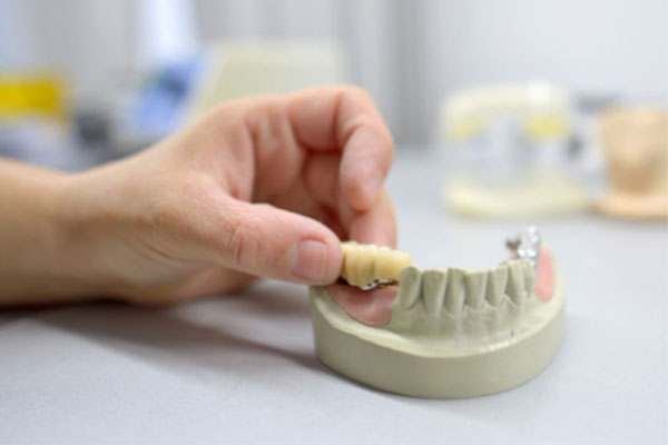 活动假牙安装详细步骤及注意事项，