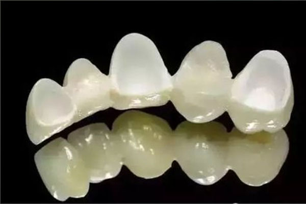 钛合金树脂牙批量定制价格揭秘 中老