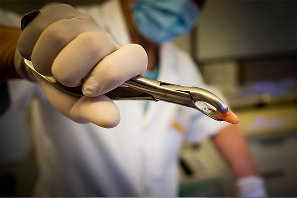 牙疼别慌！一文告诉你什么时候该拔