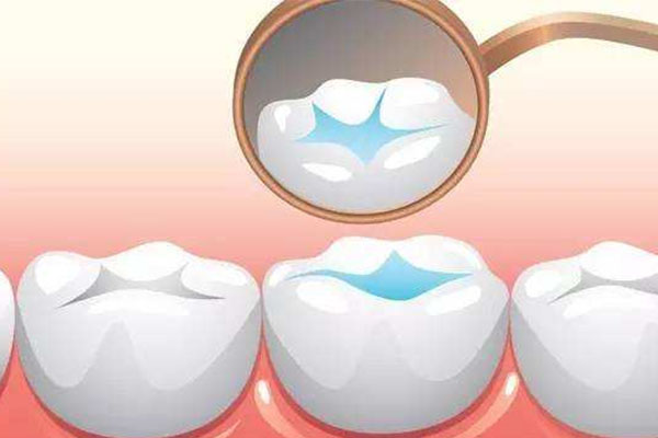 孩子牙齿涂氟有必要吗？中老年口腔提醒您全家口腔健康更重要