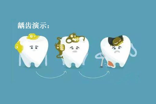 长蛀牙会好吗？中老年口腔批量修复