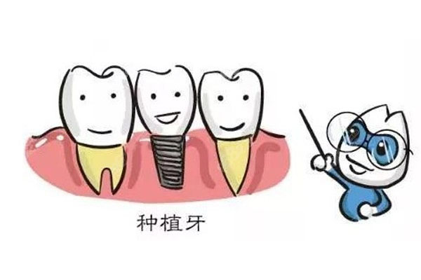 种牙多少岁可以种？中老年口腔为您解答缺牙难题