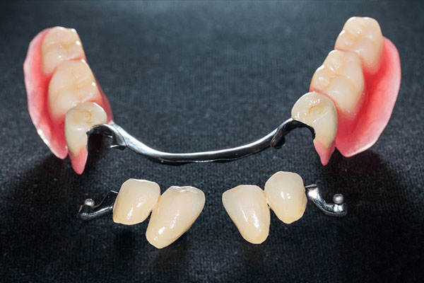 中老年牙齿缺失必看！重庆义齿加工