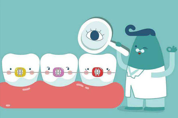 正畸保持器终身佩戴的正确方法与注