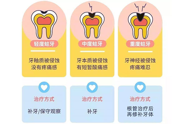 牙齿上有黑色刷不掉是蛀牙吗？中老年口腔告诉你真相