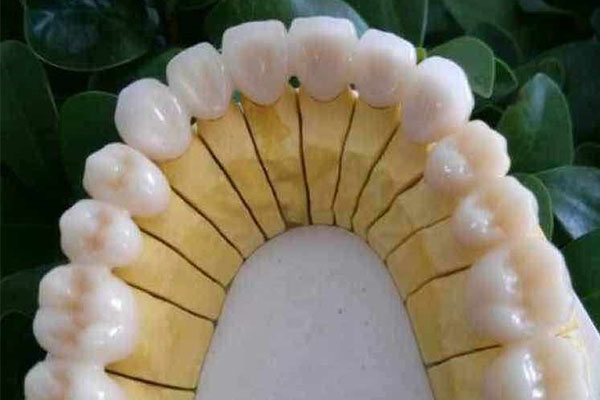 假牙制作揭秘：中老年口腔如何用批量技术实现高效修复？