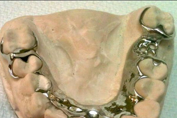 活动义齿与活动假牙的区别在哪里？