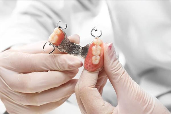 老人镶牙活动好还是固定好？中老年