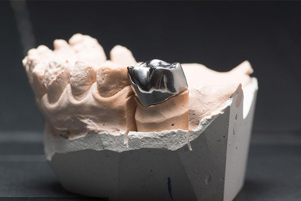 活动义齿 vs 镶牙：哪个更适合中老年