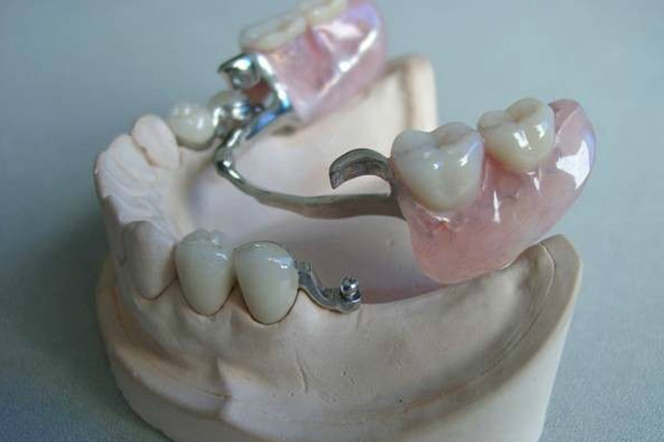 中老年缺牙福音！义获嘉吸附义齿三