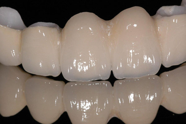 2024无铍烤瓷牙套价格表出炉！中老年口腔批量修复省钱攻略