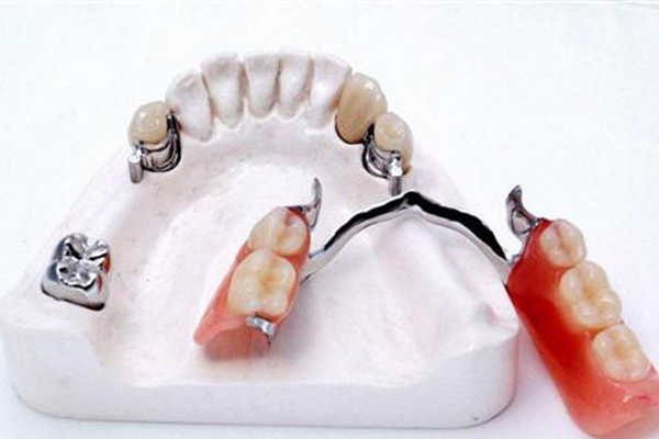 义齿加工费用多少？别让高价耽误口