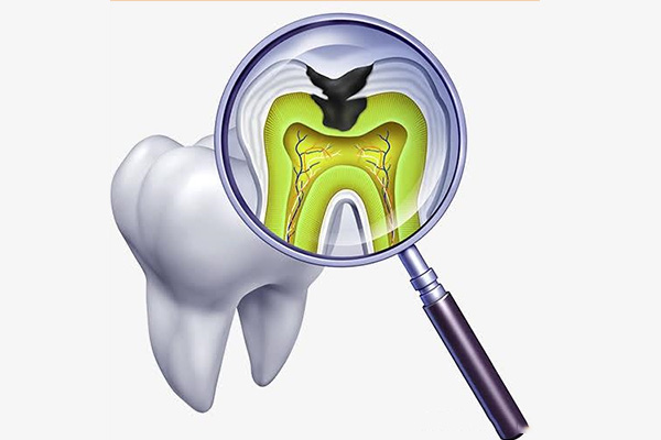 拔完智齿疼几天？脸肿几天能消肿？中老年口腔专家为您解答！
