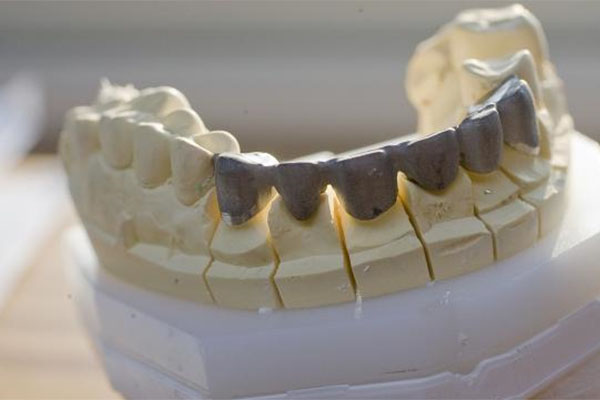 活动假牙哪种材料好？中老年口腔为