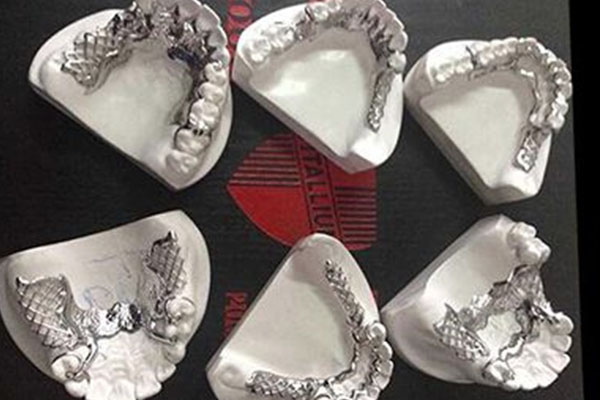 必看！中老年口腔专家揭秘：种植义齿材料选择全攻略，省钱省