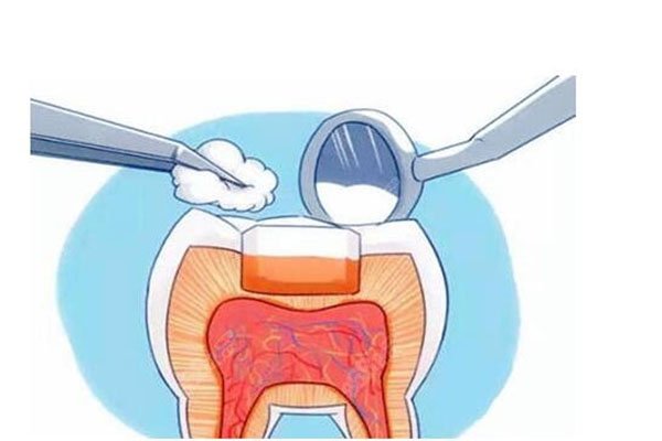 中老年口腔：补牙多少钱一颗？批量
