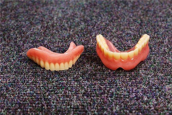 上海义齿加工厂哪家好？中老年口腔批量定制高效修复，缺牙老