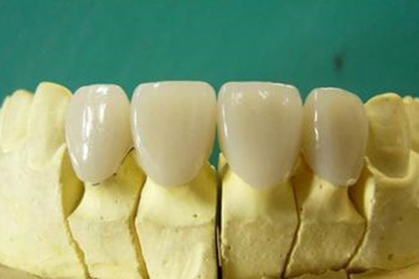 300元烤瓷牙真能修复缺牙？中老年口腔专家揭秘高效省钱方案