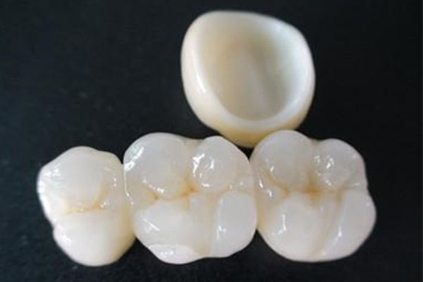 牙冠多少钱一颗？中老年口腔批量修