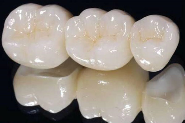 中老年口腔揭秘：烤瓷牙能用多久？