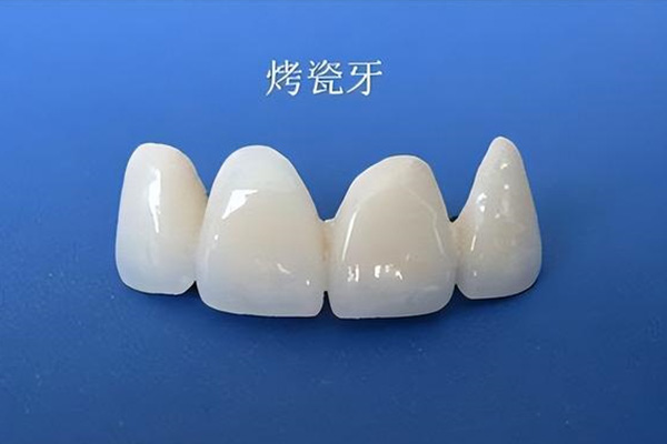 中老年口腔：缺牙修复别再花冤枉钱