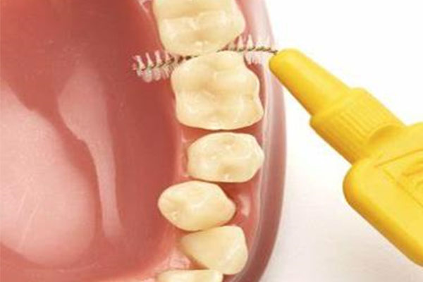 泰迪洗牙多少钱？中老年口腔专业团队揭秘高效洁牙方案