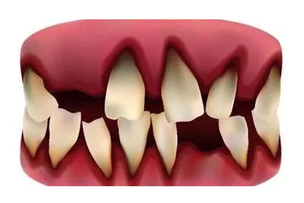 孩子牙齿自然脱落后多久可以吃饭喝水