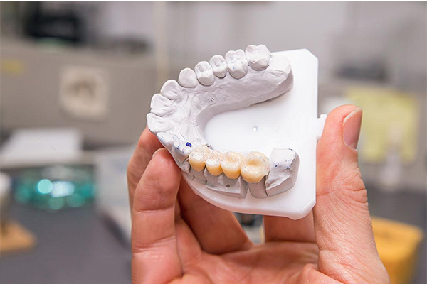 中老年缺牙必看 吸附假牙和活动假牙