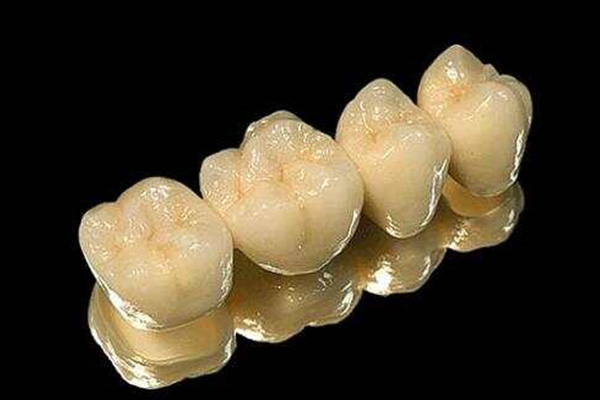 国产烤瓷牙价格揭秘：3000元起享中老