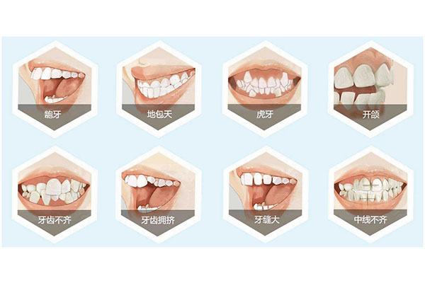 牙齿松动是什么原因引起的？中老年口腔为您解析真相