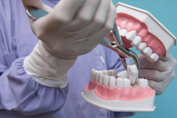 门牙固定义齿能用多久？中老年口腔批量高效方案让您的笑容更