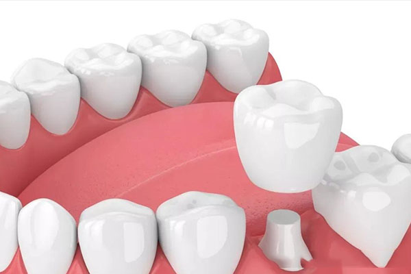 杭州哪家医院种牙进医保？中老年口