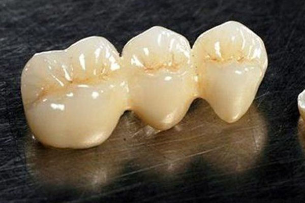 成品树脂排水沟多少钱一米？300×50