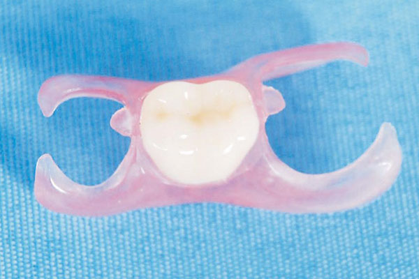 夕阳红口腔活动假牙：批量高效修复