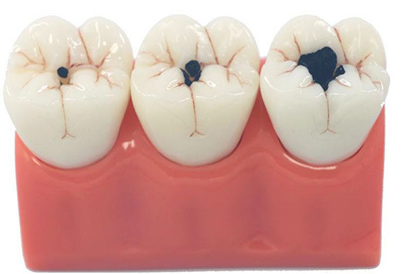 中老年口腔专家：牙疼不止？最快止