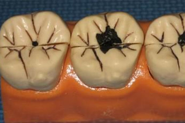 中老年口腔专家：牙痛难忍，应该怎