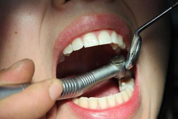 牙髓炎患者福音：中老年口腔推荐的