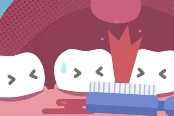 洗牙几十块钱，真的靠谱吗？