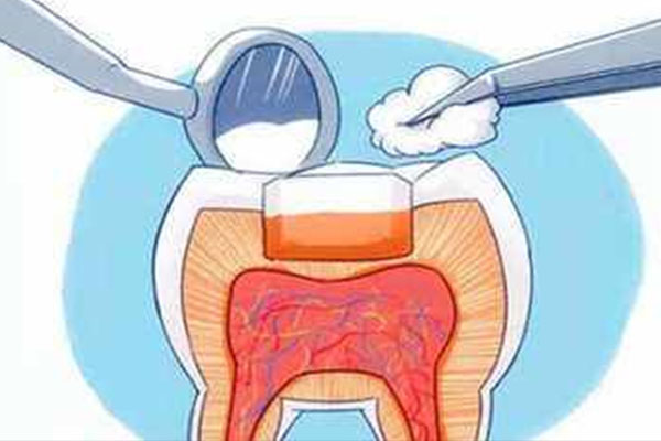 补牙后不能用力咬食物？中老年口腔教您如何快速恢复咀嚼功能