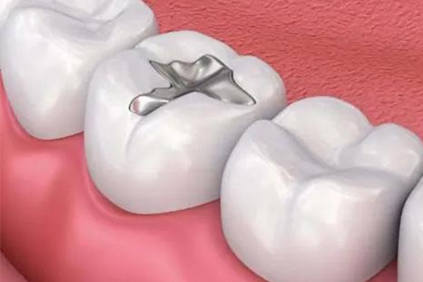 补牙后牙龈总出血？中老年口腔教你3招快速止血不求人